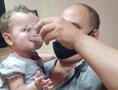فريق طبى بالإسكندرية ينجح فى زراعة قولون لطفلة 7 شهور ولدت بدون مرىء