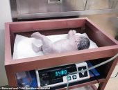ولادة الطفل الثانى من جنين متجمد بعد ولادة توأمه بـ 10 سنين  