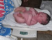 ولادة طفل باستخدام تقنيات التنويم المغناطيسى وزنه 5 كيلو جرام