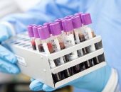 FDA توافق على اختبارين لقياس عدد الأجسام المضادة بعد الإصابة بكورونا
