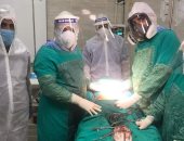 صور.. عملية جراحية لمصابة بكورونا تعانى من "قرحة منفجرة بالمعدة" بالأقصر 