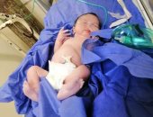 نجاح أول عملية ولادة قيصرية لمريضة كورونا بمستشفى الإسماعيلية للعزل.. صور