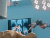 تقنية صينية فائقة.. ابتكار روبوت طبى لإجراء جراحات العمود الفقرى "فيديو"