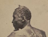 تشويه وتعذيب.. صورة عمرها 157 عاما تكشف وحشية العبودية.. وهذه حكايتها