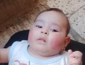 لجنة حماية الطفل بكفر الشيخ :إجراء الكشف الطبى على الطفلة "مكة" 