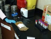 مدير خدمات نقل الدم: تكنولوجيا تصنيع مشتقات البلازما موجودة فى 14 دولة فقط على مستوى العالم 