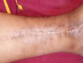 شاب من القليوبية عاجز بنسبة 35% ويحلم بمعاش تكافل وكرامة.. صور