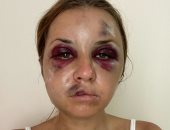 مذيعة أوكرانية تروى قصة اغتصابها وضربها فى قطار وسط صراخ ابنها.. فيديو وصور
