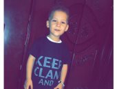 قارئ يناشد الصحة التدخل لاجراء جراحة للطفل "مازن" بعد تعرضه لحادث