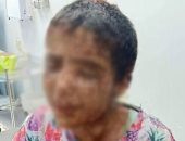 أسرة الطفلة ضحية التعذيب: لجنة من التضامن زارت أمنية وقدمت الدعم لها
