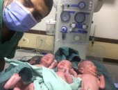 للمرة الثانية فى أسبوع.. ولادة سيدة لـ3 توائم بمستشفى أرمنت غرب الأقصر