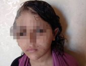 قارئ يناشد وزارة الصحة التدخل لعلاج ابنته لمعاناتها من وحمة دموية بالرأس