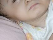 الصحة توجه الطفلة أمل لمستشفى أطفال مصر لمناظرة حالتها صباح الغد 