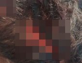 الاعتداء على طالب جامعى بأسلحة بيضاء وسرقة متعلقاته بالمحلة.. صور وفيديو