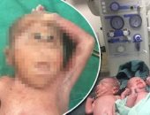 أخبار المحافظات اليوم.. ولادة طفل بـ"عين واحدة" فى الأقصر