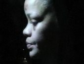 ريهانا تظهر بكدمات فى وجهها بعد سقوطها من أعلى دراجة كهربائية.. صور