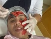 تنظيف بشرة وحقن بلازما لـ حسن شاكوش وعمر كمال فى تونس.. فيديو