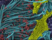 علماء ينشرون صوراً لفيروس كورونا يصيب خلايا الجهاز التنفسى