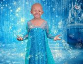 "أريانا" 5 سنوات مصابة بسرطان الكلي تتألق في جلسة تصوير أميرات ديزنى