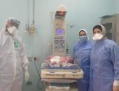 نجاح عملية ولادة قيصرية لتوأم من سيدة مصابة بفيروس كورونا في الإسكندرية