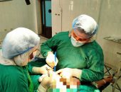 16 عملية استئصال أورام الثدى وجراحة الفكين بمستشفيات الشرقية.. صور