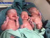 ولادة 3 توائم بمستشفى الأقصر العام