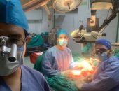 فريق طبى بجامعة أسيوط ينجح فى إجراء جراحة معقدة لتوصيل ذراع مبتورة لطالبة