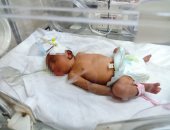 مصرع طفل متاثرا بإصابته بالماء المغلى فى المنيا