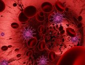 جلطات الدم أدت لزيادة خطر الوفاة لمرضى كورونا بنسبة 74%