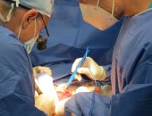 نجاح أول عملية استئصال للفص الأيسر من الكبد بمستشفى التضامن فى بورسعيد