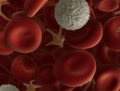  حقائق عن سرطان الدم.. قد يحدث قبل ظهور الأعراض بسنوات