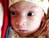 محافظ كفر الشيخ يطمئن على حالة طفل بعد إجرائه لعملية على نفقة الدولة.. فيديو وصور