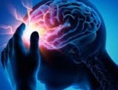 علماء ألمان: التحفيز العميق للمخ يمنع نوبات الصرع