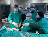 جراحة نادرة لرضيع عمره 5 أيام مصاب بانسداد المرىء في جامعة طنطا