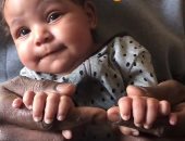 تفاعل كبير مع فيديو "تيك توك" لطفلة بريطانية مولودة بـ12 إصبعا فى يديها