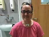 بريطانية تفقد أطرافها نتيجة مضاعفات نادرة لفيروس كورونا.. صور