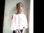 طفلة يمنية بساق واحدة توجه رسالة مؤثرة للأمم المتحدة.. فيديو
