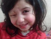 قارئ يناشد وزارة الصحة لانقاذ طفلته من وحمة دموية فى العين.. والصحة ترد