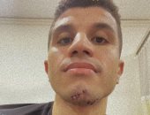 الصور الأولى للاعب الزمالك محمد عبد الغنى بعد تعرضه لإصابة فى الفك.. صور