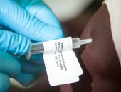 ارتفاع حصيلة الوفيات الناجمة عن تفشي "الإيبولا" في أوغندا إلى 11 حالة