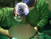 الرعاية الصحية: إجراء 20 ألف عملية جراحية بمجمع الإسماعيلية الطبى بالنصف الأول من العام الجارى