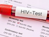 الصحة توضح الفرق بين الإصابة بالإيدز وفيرس نقص المناعة البشرى 
