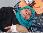 وفاة "سمرا الراوى" الناجية من قطار طهطا بكورونا داخل مستشفى حميات سوهاج