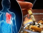 الصحة العالمية: وفاة 15شخصا كل دقيقة حول العالم بسبب تدخين التبغ 