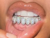 آخرهم كيم كاردشيان.. مشاهير وضعوا مجوهرات من الماس والذهب على أسنانهم