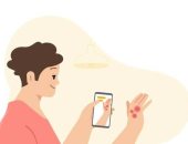 أداة جديدة من جوجل لمساعدتك فى تحديد الأمراض الجلدية باستخدام هاتفك