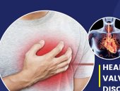 أنواع وأعراض وأسباب مرض صمام القلب