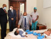 السفير البوروندى يطمئن على نجاح عملية فصل توأم من بلاده بمستشفى الدمرداش
