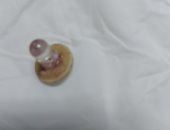 أطباء بنى سويف الجامعى يستخرجون لمبة من القصبة الهوائية لطفل.. صورة 