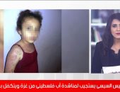 تفاصيل استجابة الرئيس السيسى لمناشدة أب فلسطينى من غزة ويتكفل بعلاج طفلته